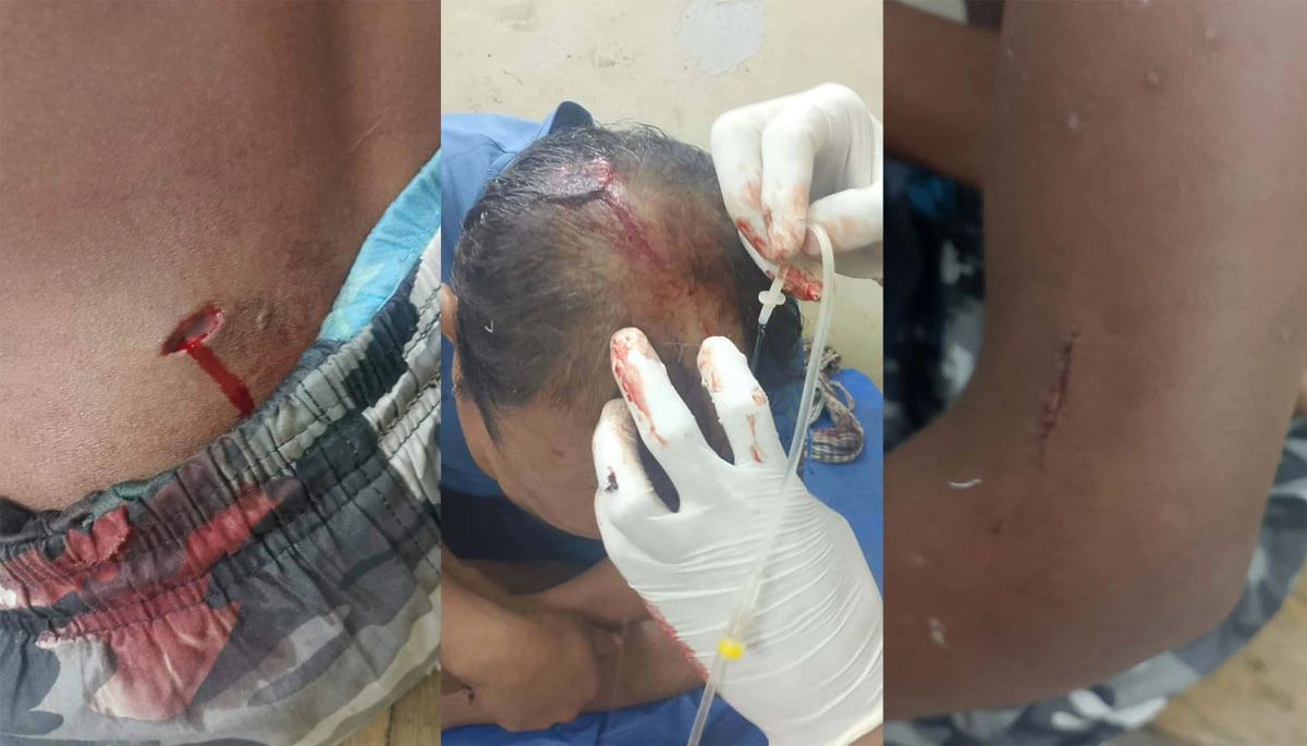 Indigenous Tripura Villagers Wounded in Violent Land Dispute Ambush in Bangladesh